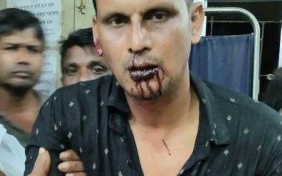 মোংলায় প্রতিপক্ষের হামলায় আ’লীগ নেতাসহ আহত ৪